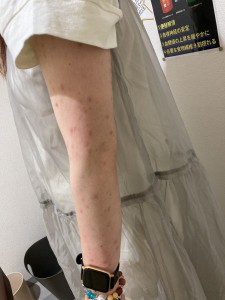 6ヶ月後の写真