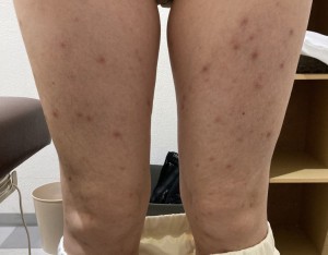 6ヶ月後の写真
