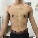 1年半後の写真