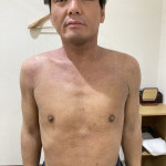 4ヶ月後の写真